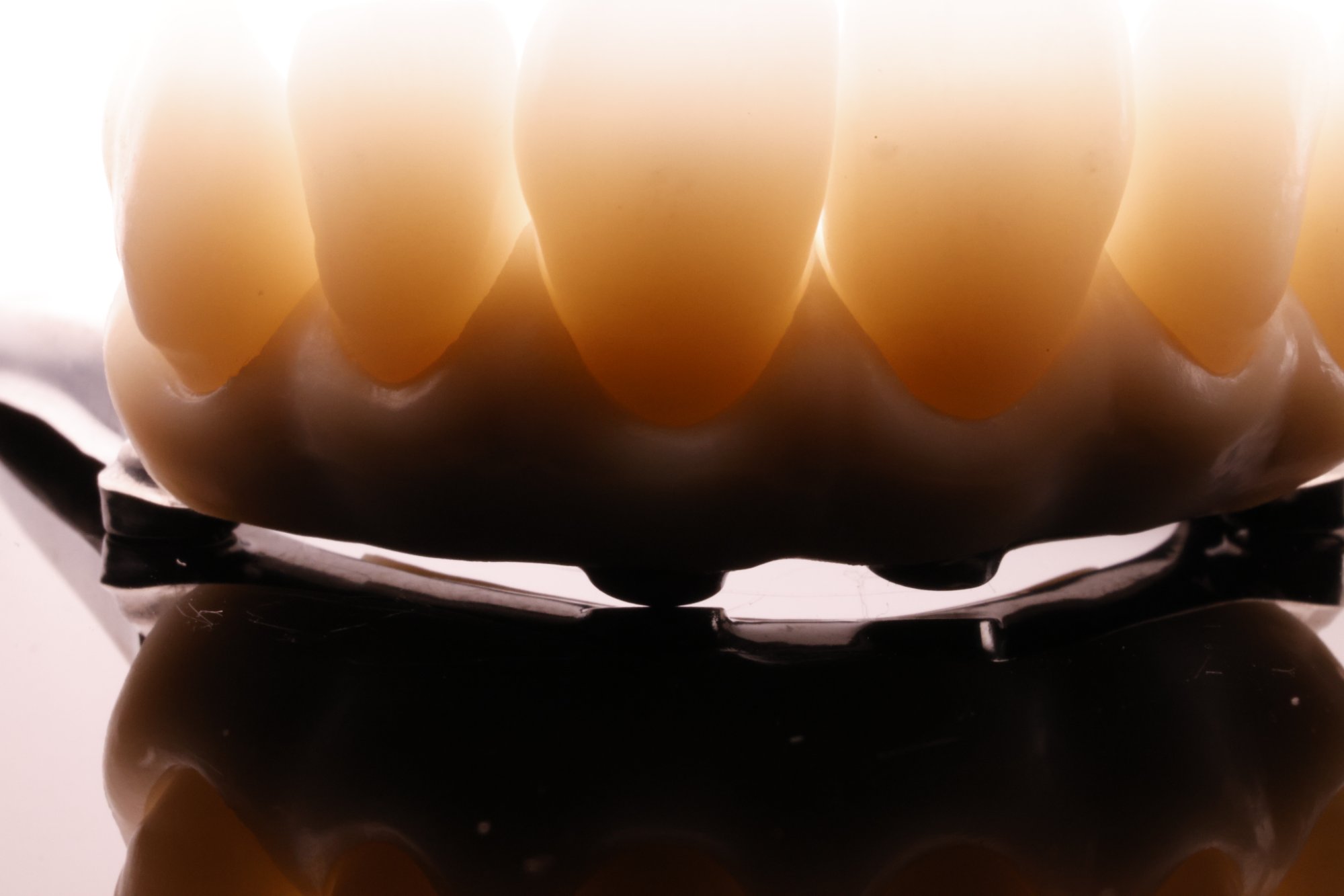 Implant prosthesis